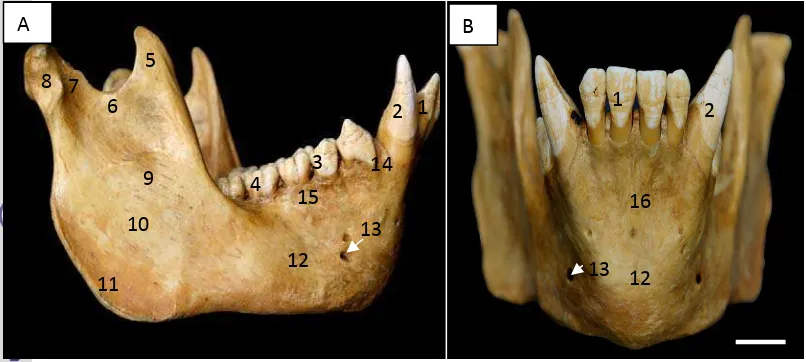 Gambar 12  Sudut pandang lateral dan kranial os mandibula. 