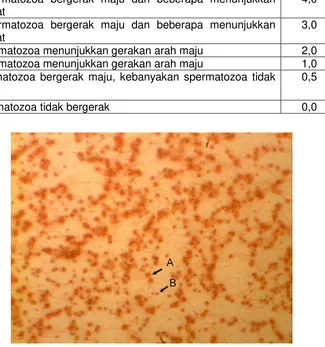 Gambar 15.   Spermatozoa ikan lele yang diamati dengan pembesaran 10X40 ,                                   A = spermatozoa hidup, B = spermatozoa mati 