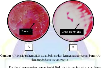 Gambar 4.7. Hasil uji hemolitik isolat bakteri dari fermentasi air cucian beras (A) 