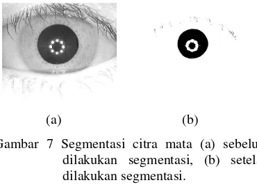 Gambar 7 Segmentasi citra mata (a) sebelum  