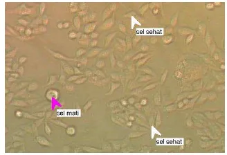 Gambar 3. Gelas obyek uji apoptosis siap diamati dengan mikroskop flouresence  