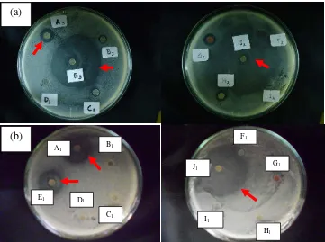 Gambar 1. Hasil Skrining Antibiotik Strain Actinomycetes umur 14 hari (a) dan umur 21 hari (b) terhadap Candida albicans 