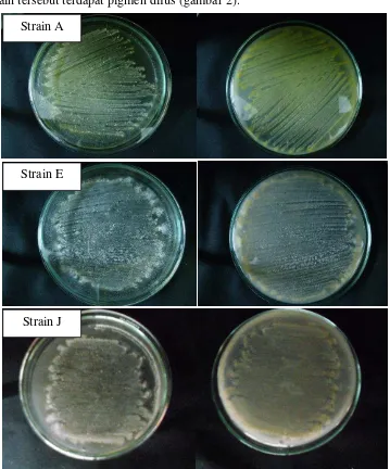 Gambar 2 Strain  Actinomycetes yang Berpotensi Antibiotik “sangat kuat” menghasilkan antibiotik dengan karakteristik warrna spora aerial (kiri) dan miselium vegetatifnya (kanan) 