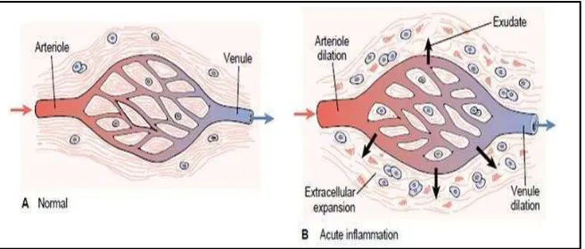Gambar 2. Marginasi leukosit pada inflamasi akut  (Spector & Spector, 1993) 