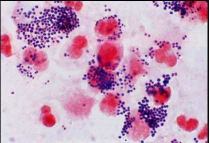 Gambar 9. Bakteri Staphylococus aureus (http://cmgm.stanford.edu/) 