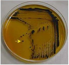 Gambar 2.7 Salmonella sp pada media SSA (Salmonella Shigella Agar) Sumber: http://www.microbiologyinfo.com 