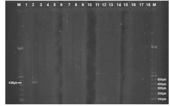 Gambar  6   Hasil deteksi DNA C. burnetii dengan elektroforesis. Ladder 