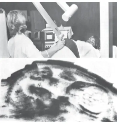 Gambar 1.22 Ultrasonografi digunakan untuk melihatperkembangan janin dalam kandungan.