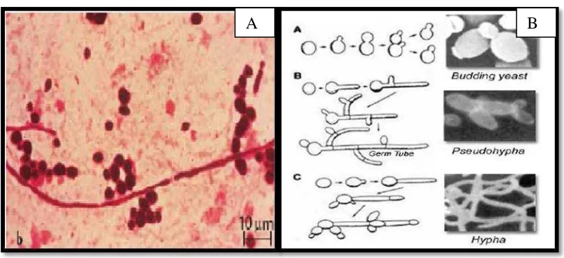 Gambar 2.2 Candida albicans (A) dan  ilustrasi morfologi C. albicans (B) (Jawetz et al., 1996 ; Hendriques, 2007) 