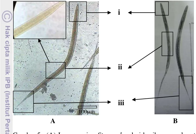 Gambar 5 (A) Larva cacing Strongylus dari hasil pemupukan tinja Landak 