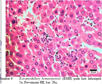 Gambar 6  Extramedullary hematopoiesis (EMH) pada hati kelompok dosis 