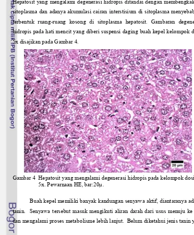 Gambar 4  Hepatosit yang mengalami degenerasi hidropis pada kelompok dosis 