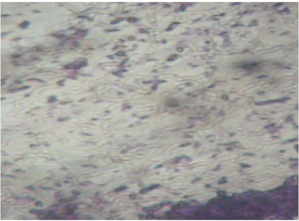 Gambar IV.4.  Bakteri Pseudomonas Putida 