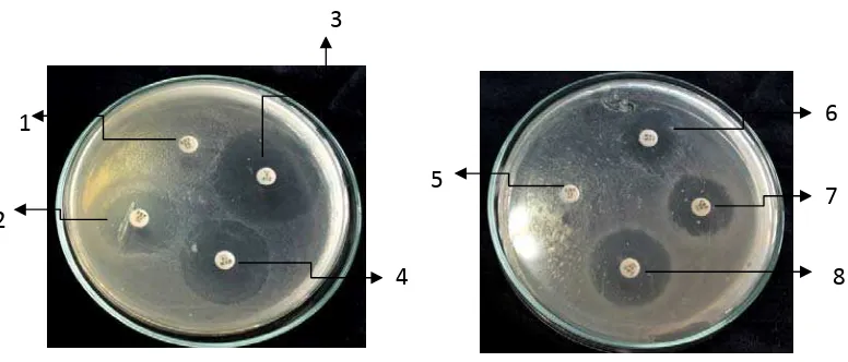Gambar 4. Uji kepekaan kuman Escerichia coliKeterangan: 1. Trimetoprim/sulfametoxazole; 2