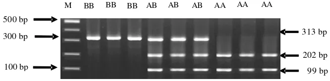 Figure 2. Genotyping of FSH Beta-subunit Gene with Pst1 Enzyme