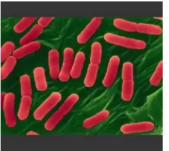 Gambar 2 Bakteri Staphylococcus aureus(Sumber : www.hartoke.files.wordpress.com)