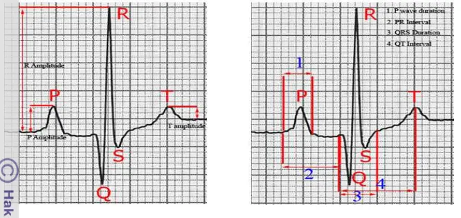 Gambar 3.   Elektrokardiogram ( O′Grady  & O′Sillivan  2010) 
