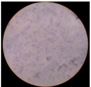 Gambar 17. Bentuk morfologi bakteri B.cereus dengan pewarnaan Gram perbesaran 1.000x 