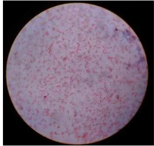 Gambar 18. Bentuk morfologi bakteri S.Typhimurium dengan pewarnaan Gram perbesaran 1.000x 