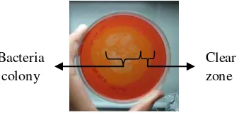 Fig 1 Screening for cellulase-producing 