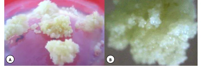 Gambar 3. Kalus embriogenik hasil perbanyakan (a) penampakan kalus di botol kultur, dan (b) penampakan secara mikroskopik pada perbesaran 10 kali