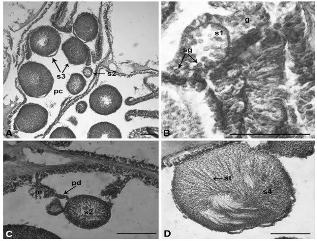 Gambar  6.   Perkembangan spermatogenesis Dendronephthya gigantea. A.   