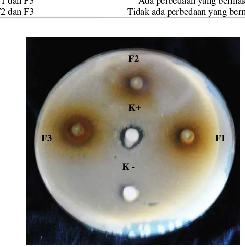 Gambar 5. Hasil uji daya antibakteri krim ekstrak etanol patikan kebo 