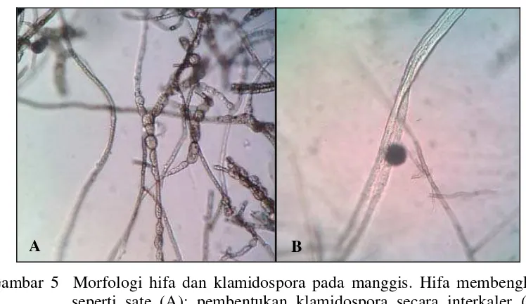 Gambar 5  Morfologi hifa dan klamidospora pada manggis. Hifa membengkak seperti sate (A); pembentukan klamidospora secara interkaler (B), dengan perbesaran 40x