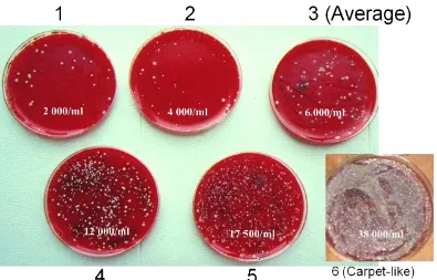 Gambar 2  Gambaran koloni mikroorganisme dari swab peralatan menurut Akira (2009). 