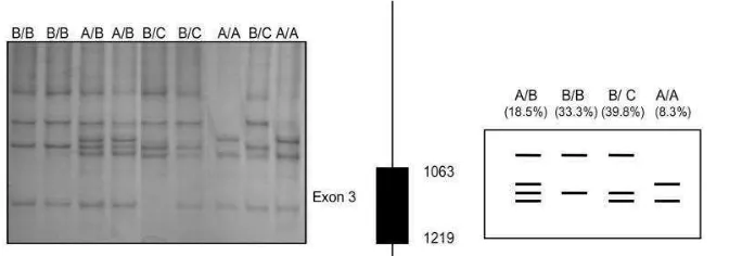 Gambar 4. Hasil Visualisasi Pita Gen GH Exon 3 pada Kambing Algarvia Melalui Teknik PCR-SSCP (Malveiro et al., 2001) 