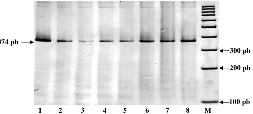 Gambar 4. Hasil Amplifikasi Gen β-Kasein Menggunakan Metode PCR pada GelPoliakrilamida 6% (M: Marker 100 pb)