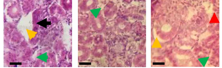 Gambar 6. Histopatologi ginjal yang terserang Vibrio sp. 3 : (     ) nekrosis, (     )