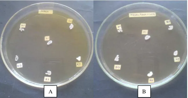 Gambar 16.  Hasil pengujian aktivitas BSH pada isolat B2, B11, B13, R1, R3, dan R9 yang ditumbuhkan pada MRSA (A) dan MRSA yang mengandung 0.5% TDCA dan 0.37g/L CaCl2 (B) tanpa menggunakan kertas saring 