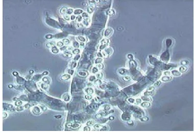 Gambar : 1. Morfologi Trichoderma sp. 