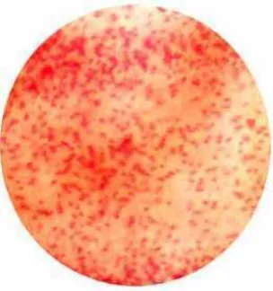 Gambar 1. Penampakan  Enterobacter sakazakii secara morfologi                          di bawah mikroskop dengan pembesaran 1000x  (Meutia 2008)  