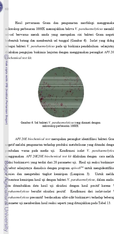 Gambar 6. Sel bakteri V. parahaemolyticus yang diamati dengan 