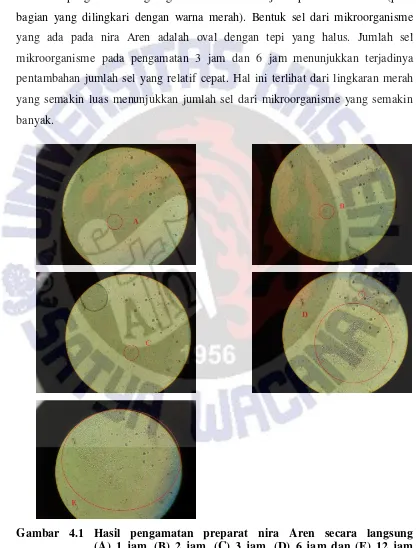 Gambar 4.1 Hasil pengamatan preparat nira Aren secara langsung                                                          (A) 1 jam, (B) 2 jam, (C) 3 jam, (D) 6 jam dan (E) 12 jam setelah pengambilan sampel nira Aren