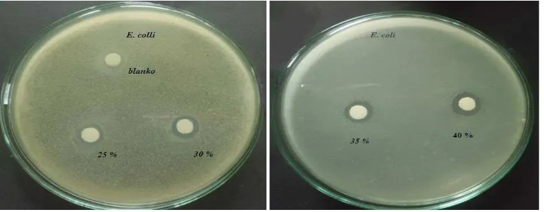 Gambar 4.2 Zona Hambat Bakteri Bacillus cereus 