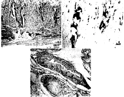 Figure 1. Ruptured colon of about 20 em long. Figure 2, 3. Numerous white granular foci of mineralization scattered along lgl