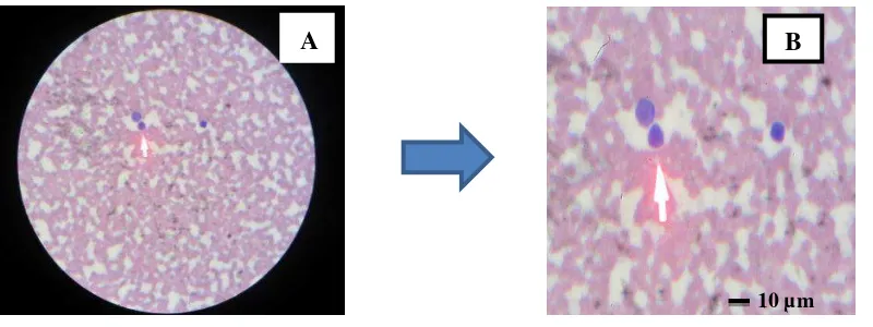 Gambar 4.3. A. Apusan Darah Jenis Limfosit diperiksa dengan mikroskop perbesaran 100x10    difoto dengan Camera digital “Canon IXUS 12,1 Mega Pixel” dengan 2x Zoom                          B