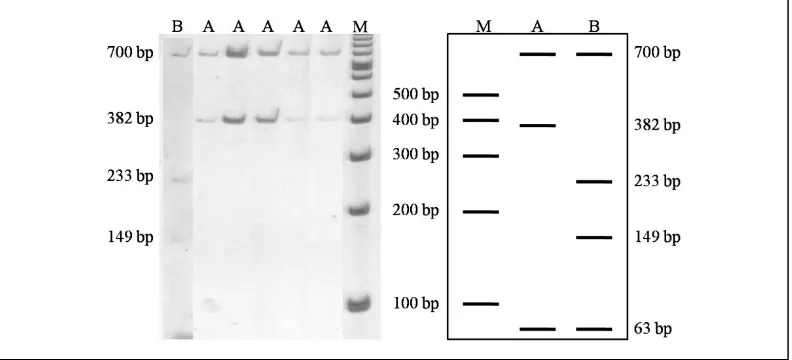 Gambar 3. Pola migrasi PCR-RFLP menggunakan enzim HaeIII. A: 609, 151, 145, 126, 63, 41 dan 10 pb 