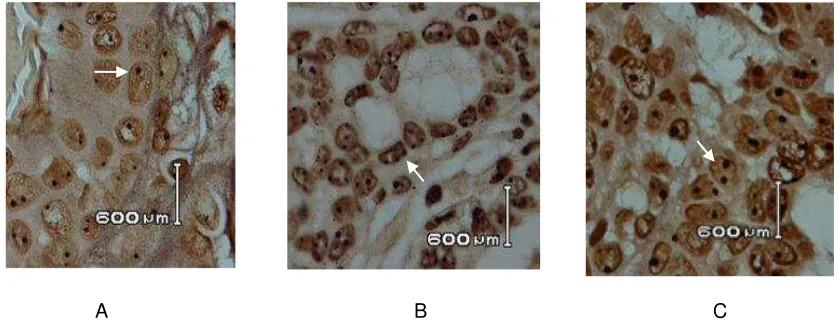 Gambar 1–Efek pemberian ekstrak terhadap jumlah black dot hasil pengecatan AgNOR. Pengecatan AgNOR dilakukan seperti pada metodologi terhadap preparat dibuat dari jaringan tumor kelenjar payudara tikus pada minggu ke-16 setelah pemberian DMBA terakhir