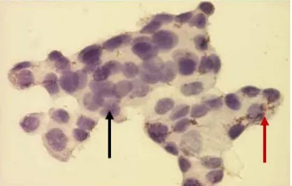 Figure 1. MCF-7 cells that express COX-2 (red arrows) and did not express COX-2 (black arrows)