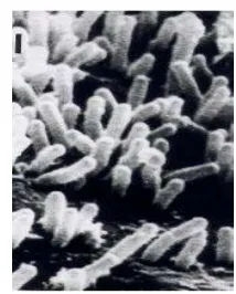 Gambar 6 Koloni  Agrobacterium 