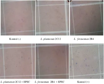 Gambar 10. Penampakan Sel Limfosit Tikus Percobaan pada Hari ke-21