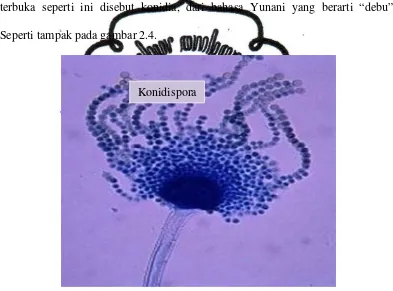 Gambar 2.4.  Konidiospora pada  Ascomikota Sumber : Biologi Gonzaga http : Blogspot.com 