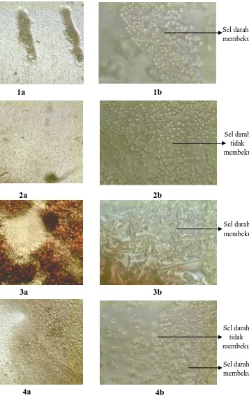 Gambar 4.2 Bentuk Mikroskopik sel darah (1) darah normal 