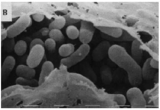 Gambar 2. Methylobacterium spp 
