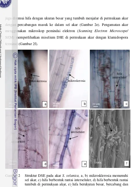 Gambar 2 Struktur DSE pada akar S. selanica, a, b) mikrosklerosia memenuhi 