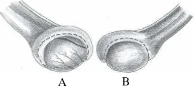 Gambar 3 Testis kucing: A. testikel kucing sudut pandang lateral; B. testikel 